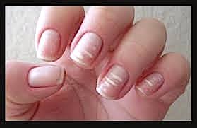 nails-white-spots